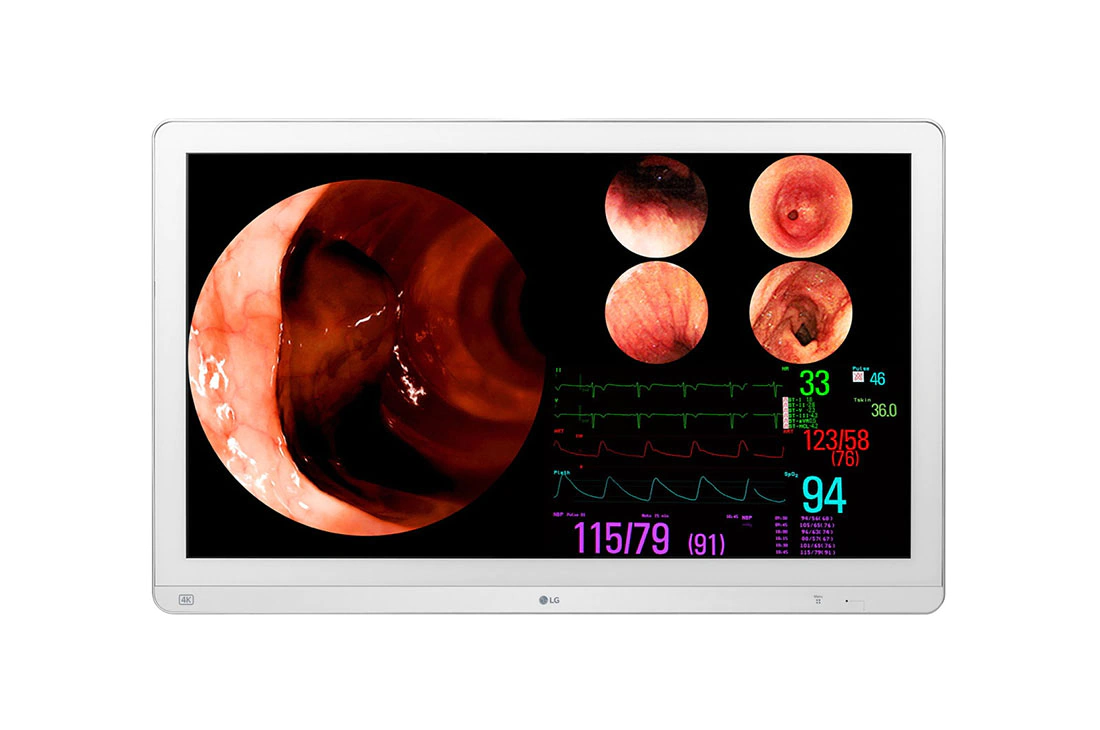 LG 31.5 (80.01cm) 4K IPS Surgical Monitor